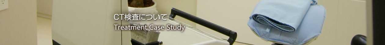 CT検査について CT検査について