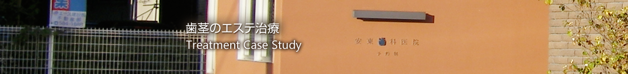 歯茎のエステ治療について