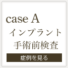インプラント手術前検査