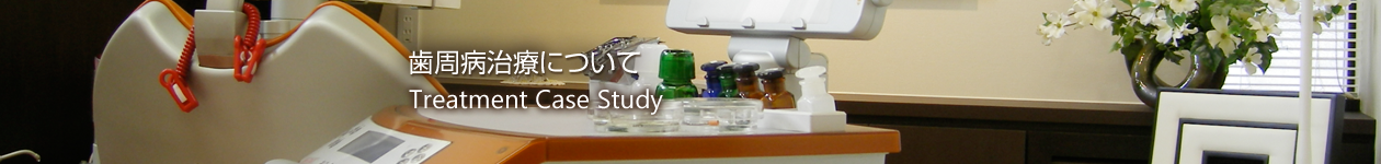 歯周病治療について