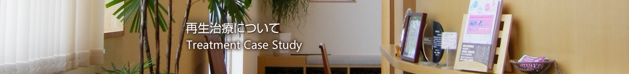 再生治療について