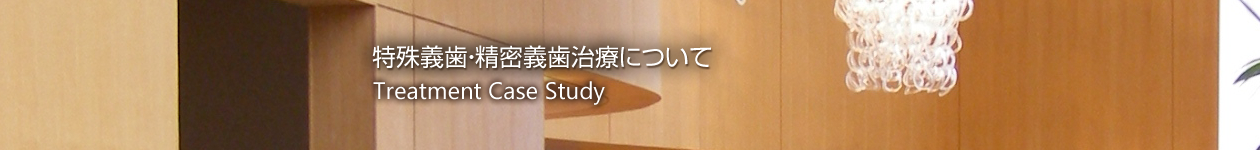 精密義歯・特殊義歯治療について