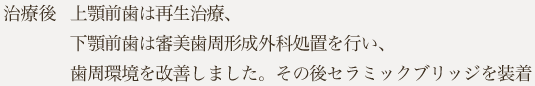 上顎前歯は再生治療、下顎前歯は審美歯周形成外科処置を行い、歯周環境を改善しました。その後セラミックブリッジを装着