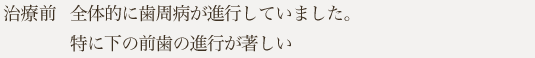 全体的に歯周病が進行していました。特に下の前歯の進行が著しい