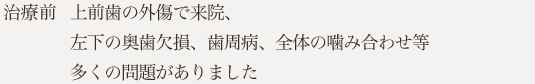 上前歯の外傷で来院、左下の奥歯欠損、歯周病、全体の噛み合わせ等多くの問題がありました