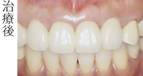 治療後