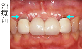 治療前