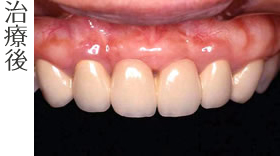 治療後
