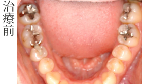 治療前