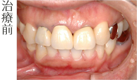 治療前