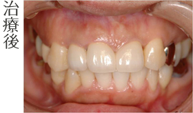 治療後