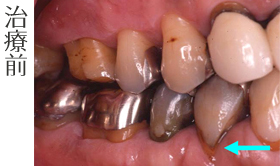 治療前