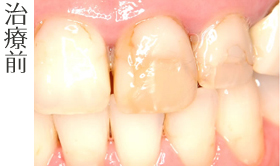 治療前