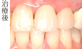 治療後