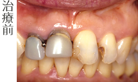 治療前