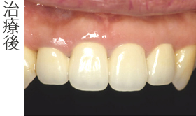 治療後